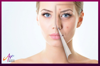 Skin beautification